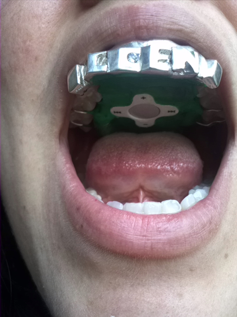 mp3 mouth jewelry